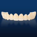 Customized Multilayered Zirconia for Dental Restoration
